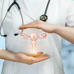 Infertility